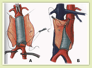 �������� �������������� �����