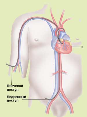 ���������� ������� � ���������� ��������