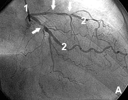 ������������� ������� ����� ���������� �������