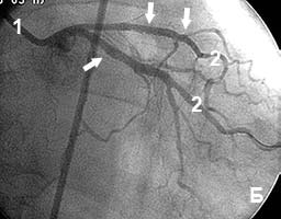 ������� ���������