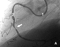 ������ ������ ���������� �������