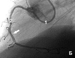 ������ ��������