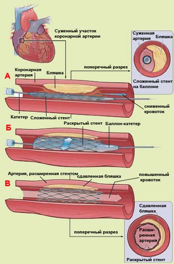 ������������� ���������� �������