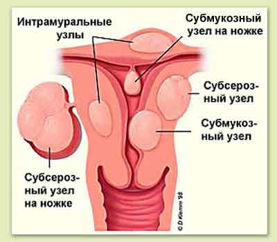 ������������ ����� �����