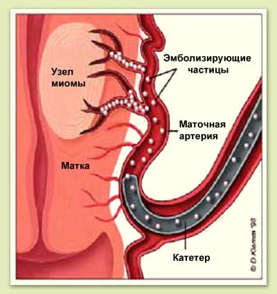 ����� ��������