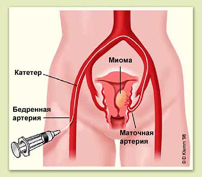 ����� ��������