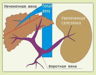 ���������������� ���������� ����