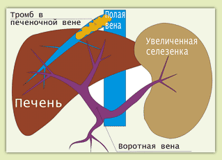 �������������� ���������� ����