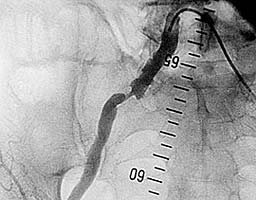 ������ �������� ����������� �������