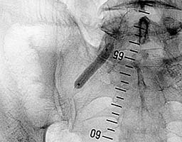 ������-������� ������ � ����� �������