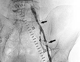 ������������� ������� �������� ����������� � ����� ��������� �������