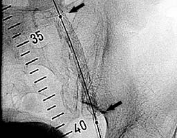 ��������� ������