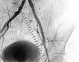 ������� ���������