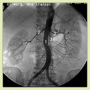 ������ �����������: �����������