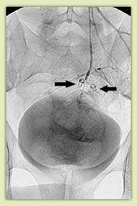 ������������ ������� ������ ����� - ����� �����������