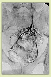 ������������ ������� ������ ����� - �� �����������