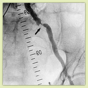 ������� �������� ����������� �������