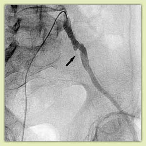 �� �� ����� ���������