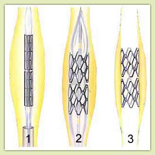 ����������������� �����