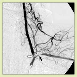 ������� ������������ � ����������� �������