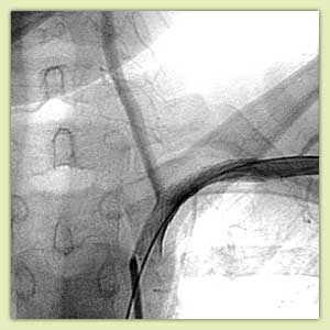 ������������� ������������ �������, ��������� �����������