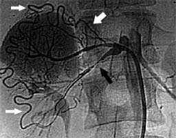 ���������������� ��������� - �� ���������