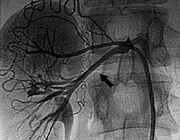 ���������������� ��������� - ����� ���������