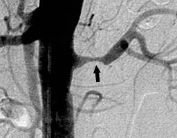 ������ ����� �������� ������� - �� �������������