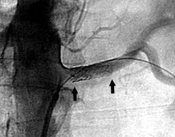 ������ ��������