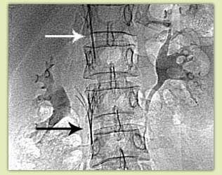 ������������� �������� �������