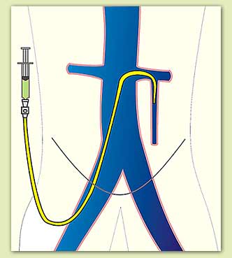 ���������� �������� � �������� ����