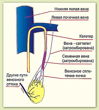 ����������� �������� ����