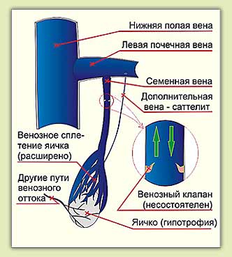 ������������� ��������� ��� ����������